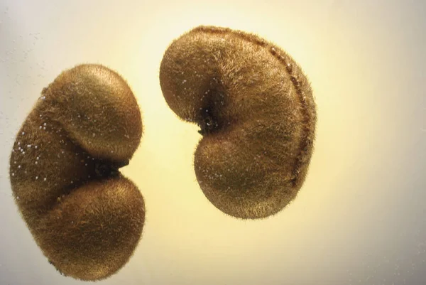 Kiwifrukter, som liknar njurarna. Njurhälsa koncept. Marknadsföring foto — Stockfoto