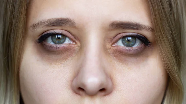 Vystřižená Fotka Mladé Ženské Tváře Zelené Oči Tmavými Kruhy Pod — Stock fotografie