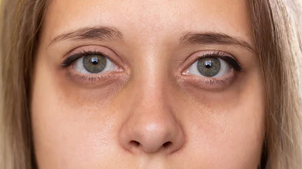 Una Foto Recortada Una Joven Cara Femenina Ojos Verdes Con — Foto de Stock