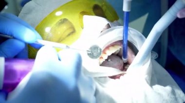 Diş hekimi asistanı diş fırçasıyla dişlerini fırçalayan bir diş hekimi.