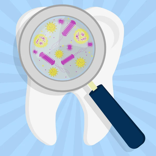 Virus et bactéries dans la dent — Image vectorielle