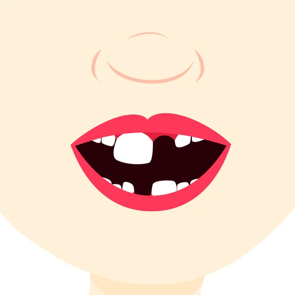 赤ちゃんの歯を持つ子供 — ストックベクタ