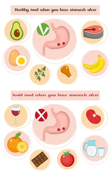 Sain et éviter les aliments si vous avez un ulcère de l'estomac infographies. Prévention des maladies de l'estomac. Concept de médecine. Illustration vectorielle — Image vectorielle