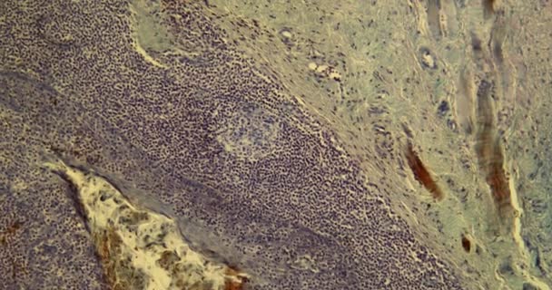 Tissu Amygdale Palatine Microscope 100X — Video