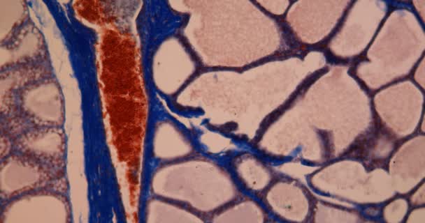 Jaringan Dari Kelenjar Susu Bawah Mikroskop 100X — Stok Video