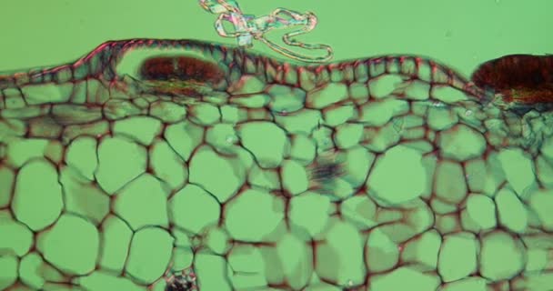 Daun Urn Dari Tumbuhan Kantong Bawah Mikroskop 100X — Stok Video
