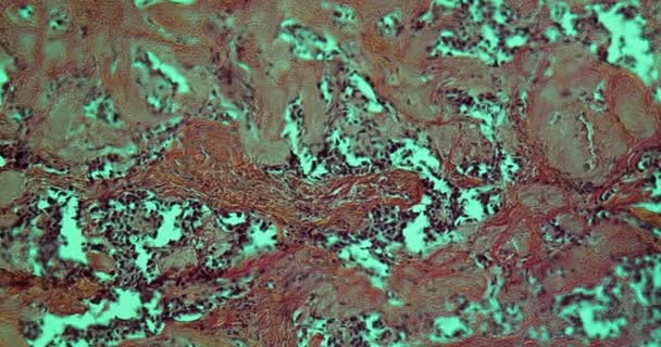 Ткани Щитовидной Железы Микроскопом 100X — стоковое видео