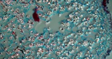 Mikroskop altında kesişen kadife otu kökü 100x