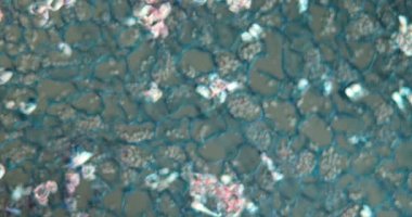 Mikroskop altında çapraz kesitte Lupine kökü 100x