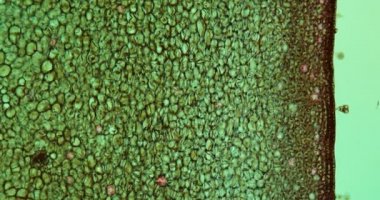 Mikroskop altında ceviz ezmesi. 100 x.