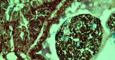 Mikroskop altında örgü dokusu 100 x