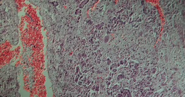 Δηλητηρίαση Του Ήπατος Από Ιστό Μανιταριών Κάτω Από Μικροσκόπιο 100X — Αρχείο Βίντεο