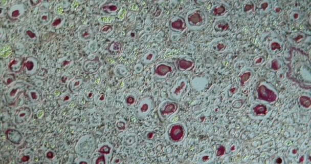 Колоїдна Тканина Нирки Під Мікроскопом 100Х — стокове відео