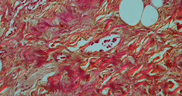 Diverticulose Gros Intestin Microscope 200X — Video