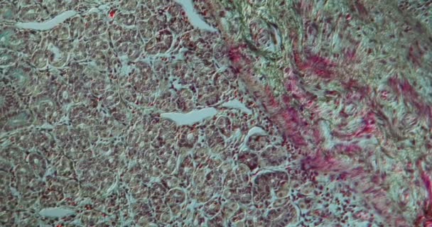 Divertikulosis Tlustého Střeva Tkáně Pod Mikroskopem 100X — Stock video