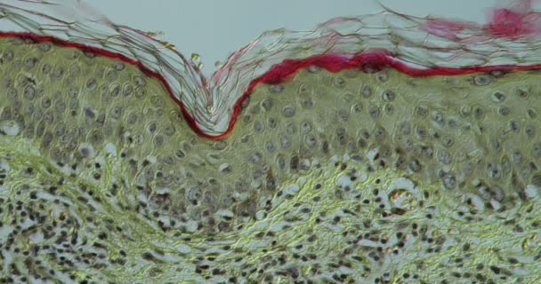 Infezione Della Pelle Tessuto Herpes Zoster Microscopio 200X — Video Stock
