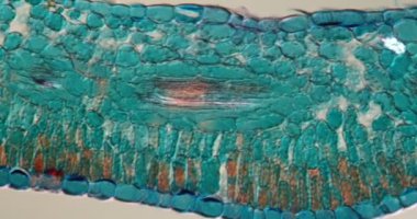 Azalea, rhododendron, dokuyu mikroskop altında bırakın. 200 x