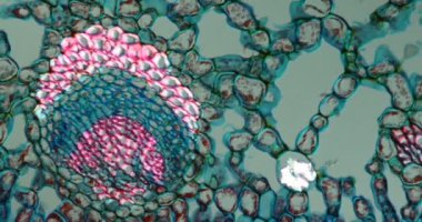 Holly dokuyu mikroskop altında bırak 200x