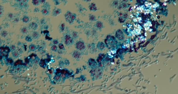 Mikroskop Altında Dokuyu Lichens 200X — Stok video