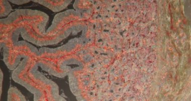 Darkfield dokusunda divertiküloz mikroskop altında 100 x