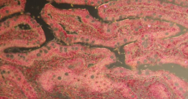 Polypes Peuz Jaeger Dans Les Tissus Darkfield Microscope 100X — Video