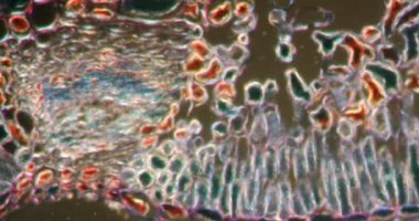 Darkfield dokusunda bogberry iznine mikroskop altında 100 x