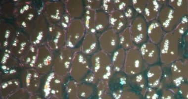 Darkfield dokusundaki vadi kökü zambağı mikroskop altında 200x