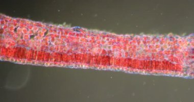 Zehirli sarmaşık Darkfield dokusunda mikroskop altında 200x