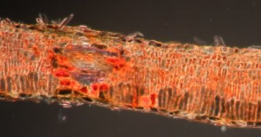 Darkfield dokusunda söğüt ağacı mikroskop altında 200x
