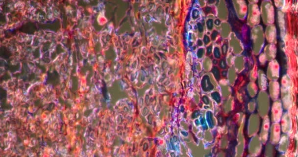 Brindille Daphné Dans Tissu Darkfield Microscope 200X — Video
