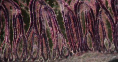 Yuvarlak kurt, Darkfield dokusundaki kas dokusu mikroskop altında 200 x