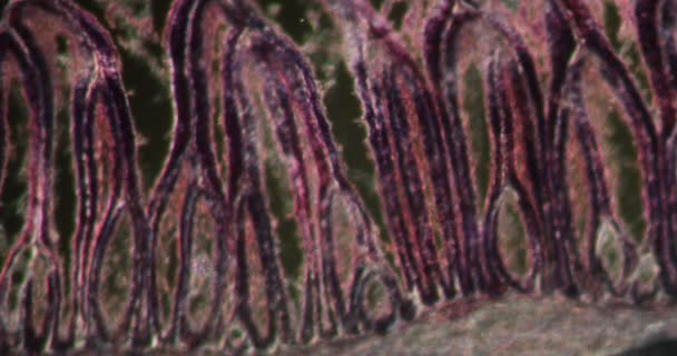 Rondworm Spierweefsel Darkfield Weefsel Onder Microscoop 200X — Stockvideo