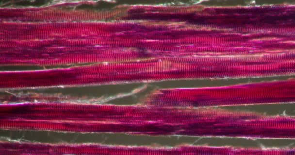 Tecido Muscular Estriado Tecido Darkfield Sob Microscópio 200X — Vídeo de Stock