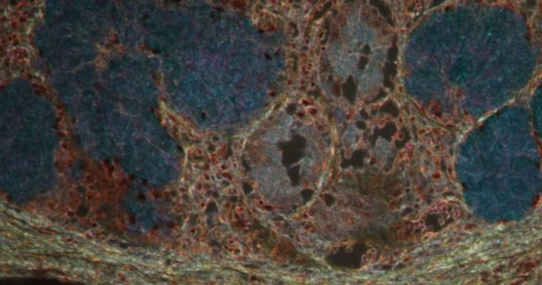 Astma Longweefsel Darkfield Weefsel Onder Microscoop 200X — Stockvideo