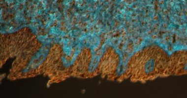 Darkfield dokusunda dil mikroskop altında 200x