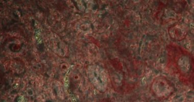 Darkfield dokusunda sirotik böbrek dokusu mikroskop altında 200x