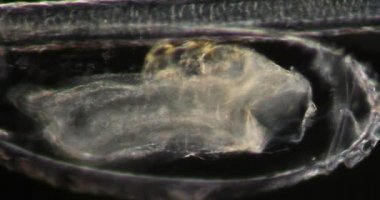 Darkfield dokusundaki saç biti mikroskop altında 200x