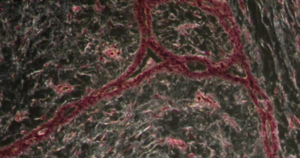 Ткани Фиброденомы Ткани Даркфилда Микроскопом 200X — стоковое видео