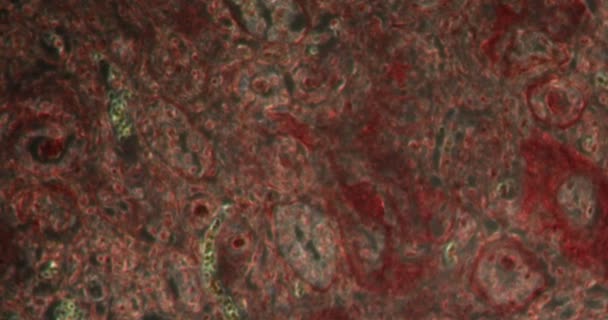 Цирротическая Ткань Почек Ткани Даркфилда Микроскопом 200X — стоковое видео