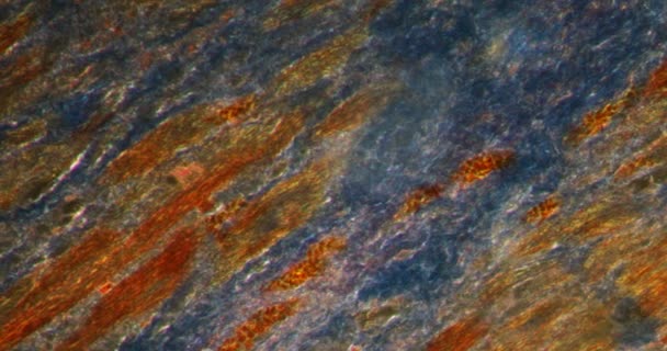 Calluses Dalam Jaringan Darkfield Bawah Mikroskop 200X — Stok Video