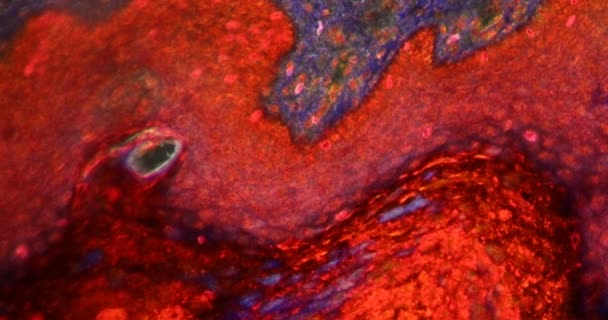 Tissu Cicatriciel Dans Tissu Darkfield Microscope 200X — Video