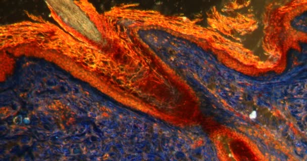Scalp Dengan Rambut Jaringan Darkfield Bawah Mikroskop 100X — Stok Video