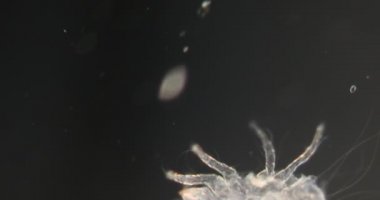 Darkfield dokusundaki toz akarları mikroskop altında 100 x