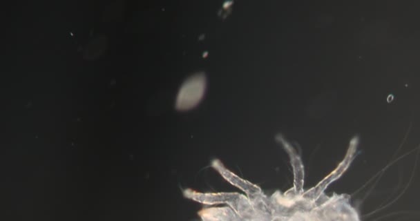 Пылевые Клещи Фото Под Микроскопом