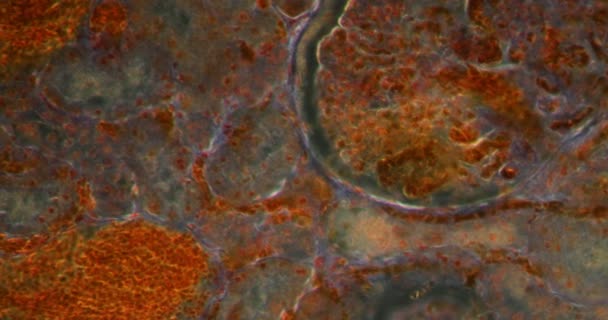 Νεφροί Jaundice Στο Darkfield Ιστό Κάτω Από Μικροσκόπιο 200X — Αρχείο Βίντεο