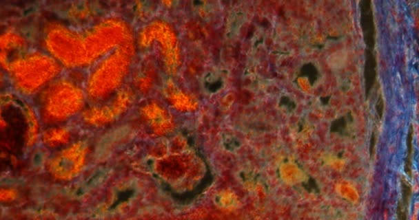 顕微鏡下でのダークフィールド組織での腎臓出血200X — ストック動画