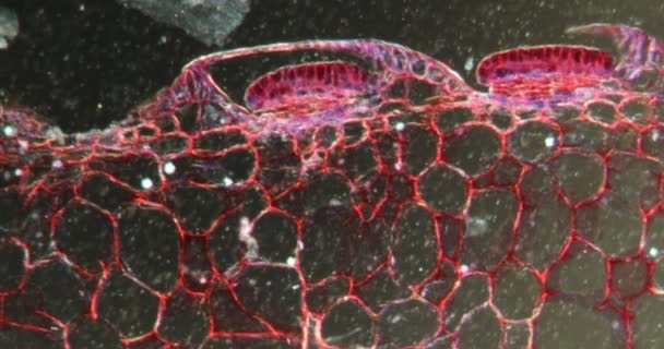 Листок Пітчера Травного Листя Тканинах Даркфілда Під Мікроскопом 100Х — стокове відео
