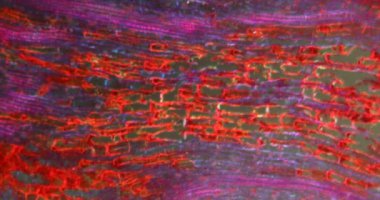 Mikroskop altında Darkfield dokusunda karaçam kozalakları var.