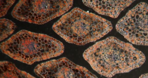 Pointe Pousse Épinette Dans Tissu Darkfield Sous Microscope 100X — Video