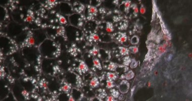 Darkfield dokusunda ökseotu meyvesi mikroskop altında 100 kat